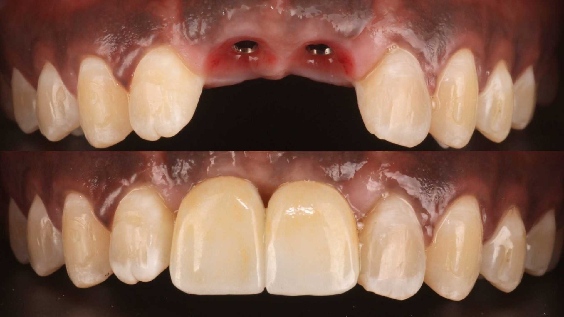 Rehabilitación Oral